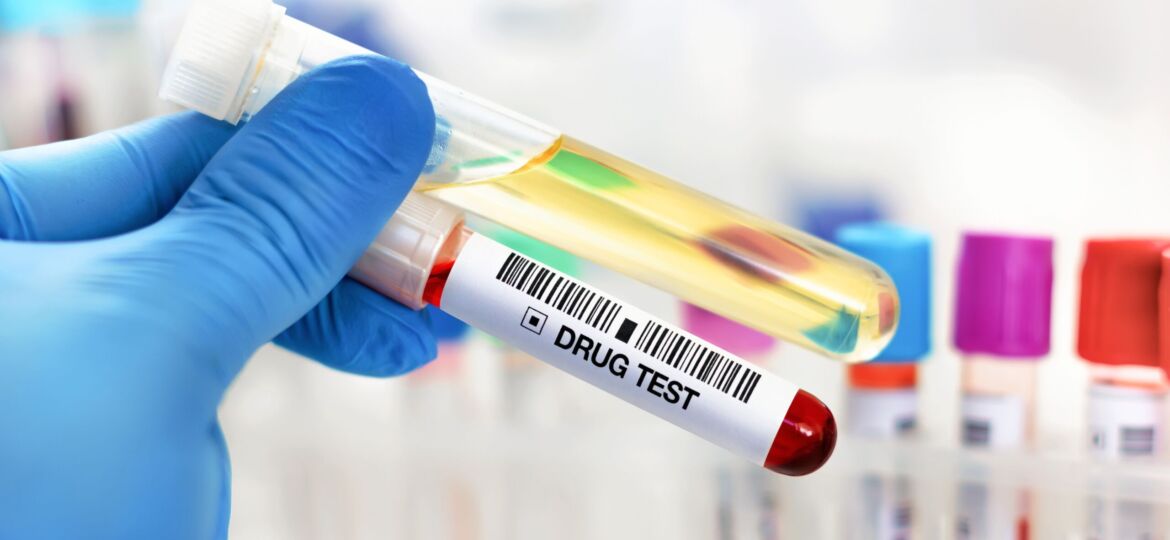 Hand holding blood and urine drug tests